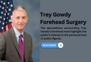 Trey Gowdy Forehead Surgery